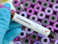 На Дніпропетровщині – ще три випадки коронавірусу